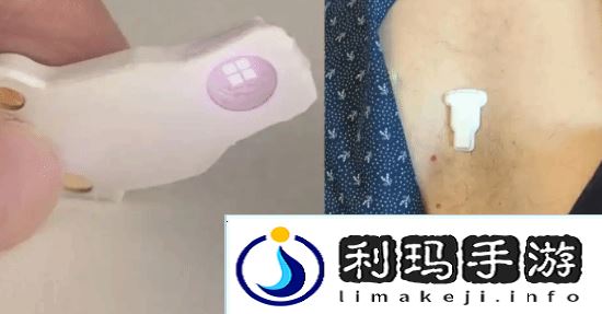 世界最小心脏起搏器问世